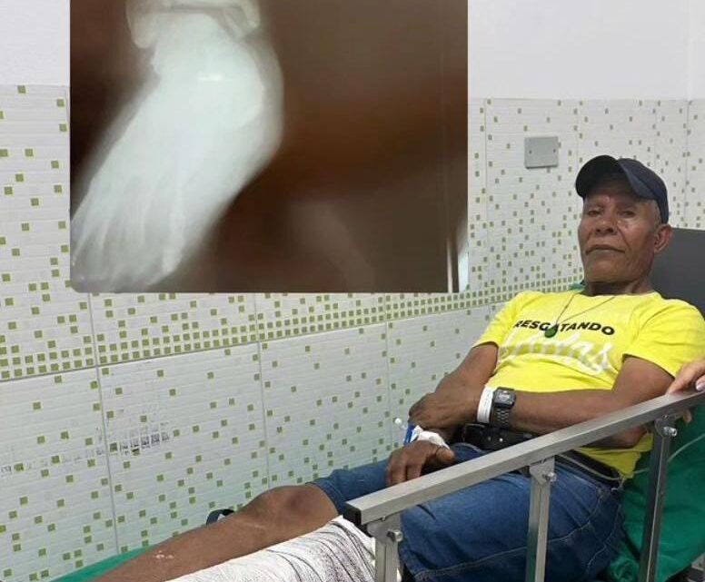 Idoso vítima de tentativa de homicídio após convenção do MDB  em Cuparaque passou por cirurgia